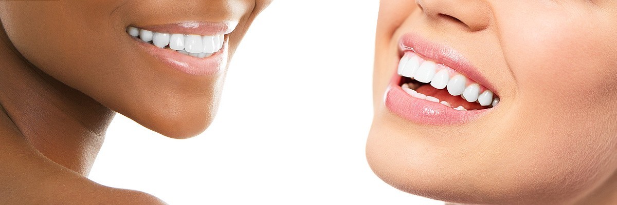 Teeth Whitening Boca Raton  Teeth Whitening for Braces West Boca